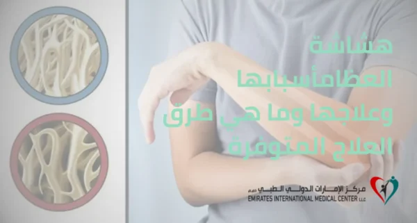 صورة توعوية توضح الفرق بين العظم السليم والعظم المصاب في مقال هشاشة العظام أسبابها وعلاجها من مركز الإمارات الدولي الطبي