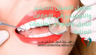 تجميل الأسنان بالفينير واللومينير في مركز الإمارات الدولي الطبي للحصول على ابتسامة مشرقة وجذابة