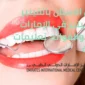 تجميل الأسنان بالفينير واللومينير 85x85
