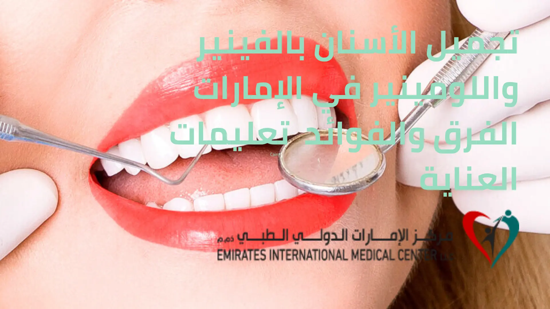 تجميل الأسنان بالفينير واللومينير في مركز الإمارات الدولي الطبي للحصول على ابتسامة مشرقة وجذابة