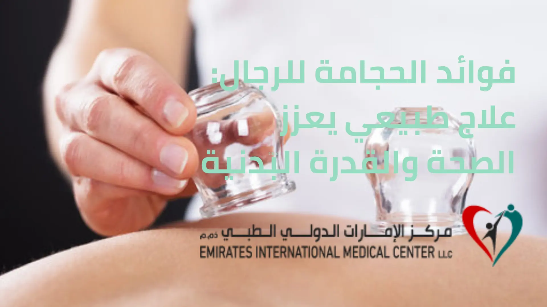 فوائد الحجامة للرجال: جلسة حجامة باستخدام الكؤوس الزجاجية لتعزيز الصحة والقدرة البدنية في مركز الإمارات الدولي الطبي