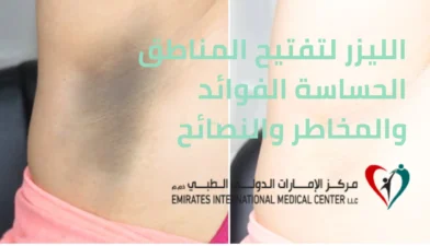 الليزر لتفتيح المناطق الحساسة الفوائد والمخاطر والنصائح قبل وبعد الجلسات