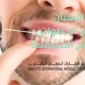 زراعة الأسنان الأنواع، الخطوات، والنتائج المتوقعة 85x85