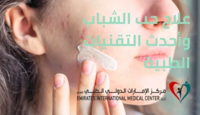 علاج حب الشباب وأحدث التقنيات الطبية