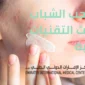 علاج حب الشباب 85x85