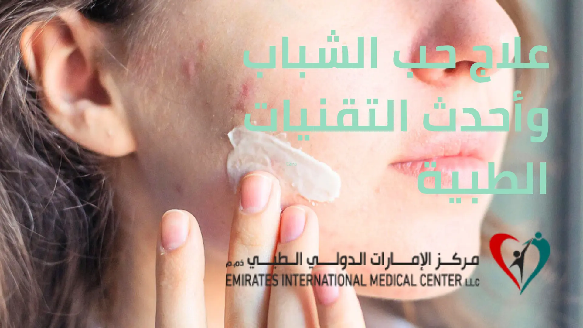علاج حب الشباب وأحدث التقنيات الطبية