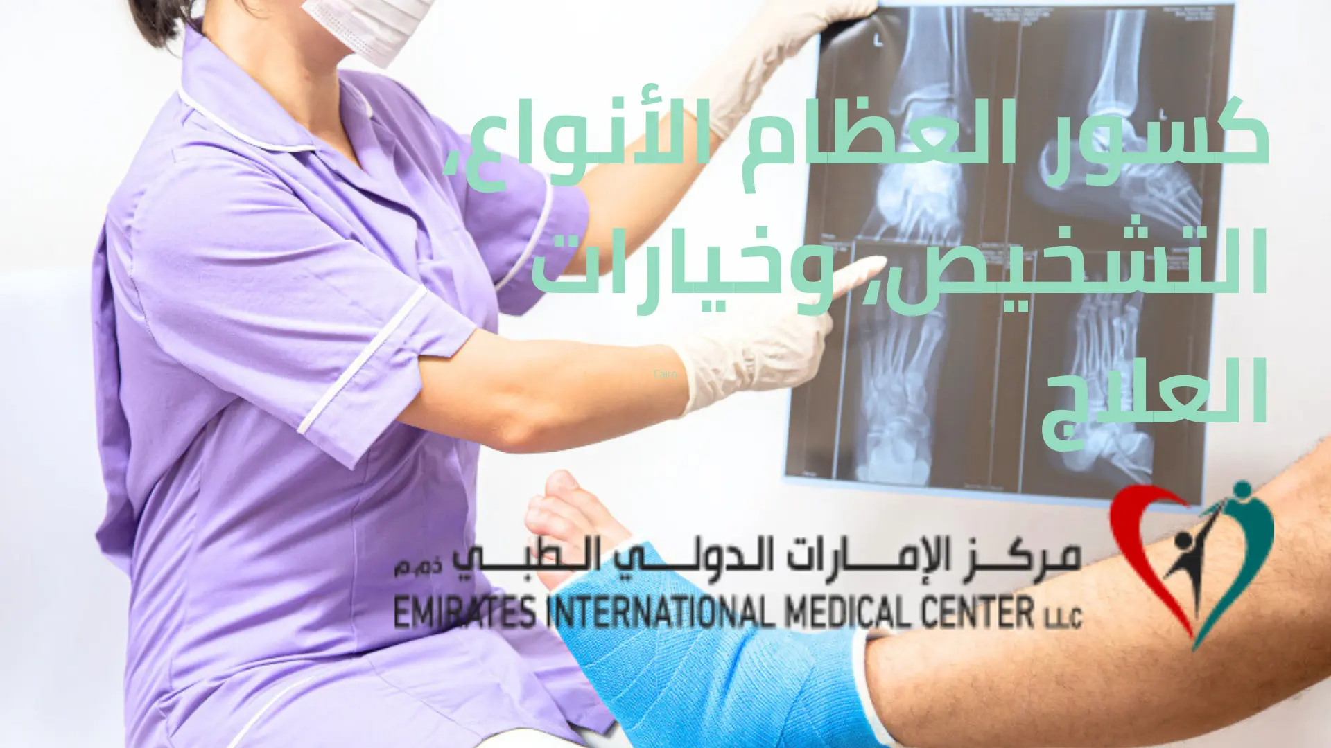 كسور العظام الأنواع، التشخيص، وطرق العلاج الحديثة