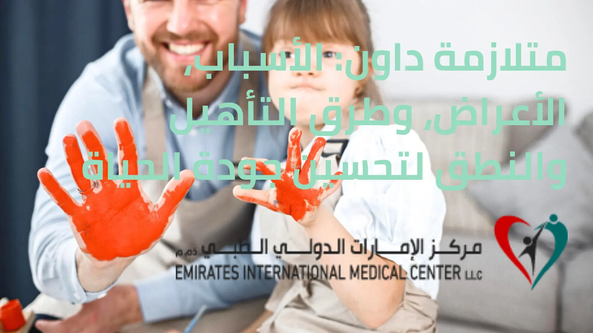 متلازمة داون: الأسباب، الأعراض، وطرق التأهيل والنطق لتحسين جودة الحياة