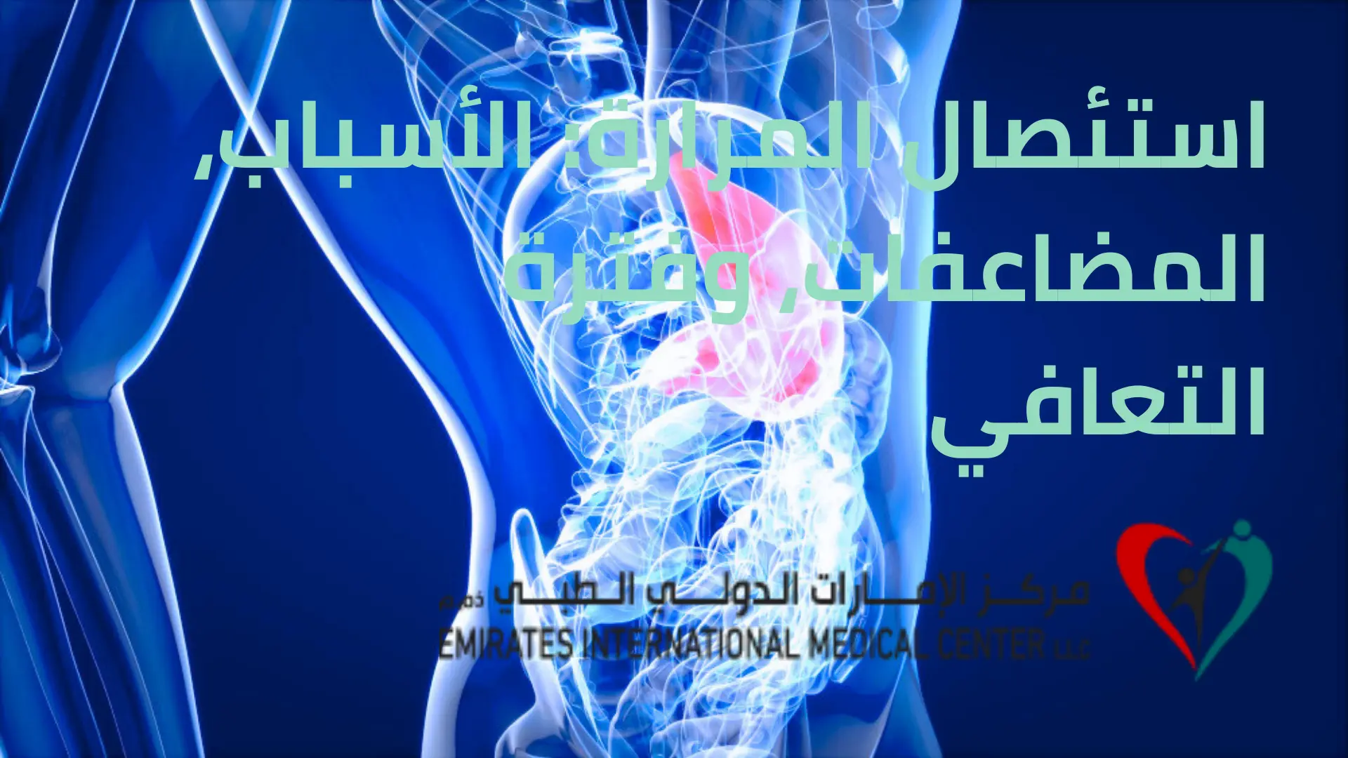استئصال المرارة الأسباب، الأعراض، طرق العلاج وفترة التعافي