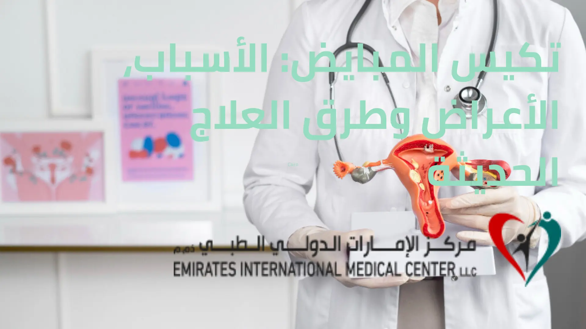تكيس المبايض الأسباب، الأعراض وطرق العلاج الحديثة