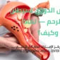 الفحص الدوري لسرطان عنق الرحم 85x85
