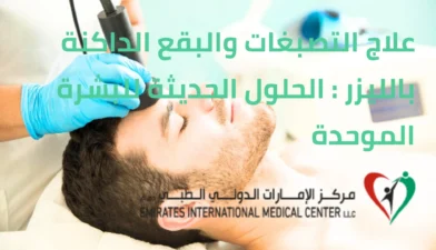 علاج التصبغات بالليزر والبقع الداكنة: الحلول الحديثة للبشرة الموحدة