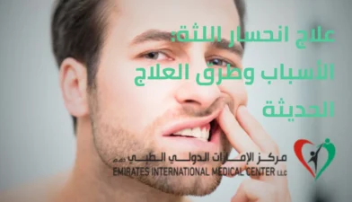 انحسار اللثة: الأسباب وطرق العلاج الحديثة