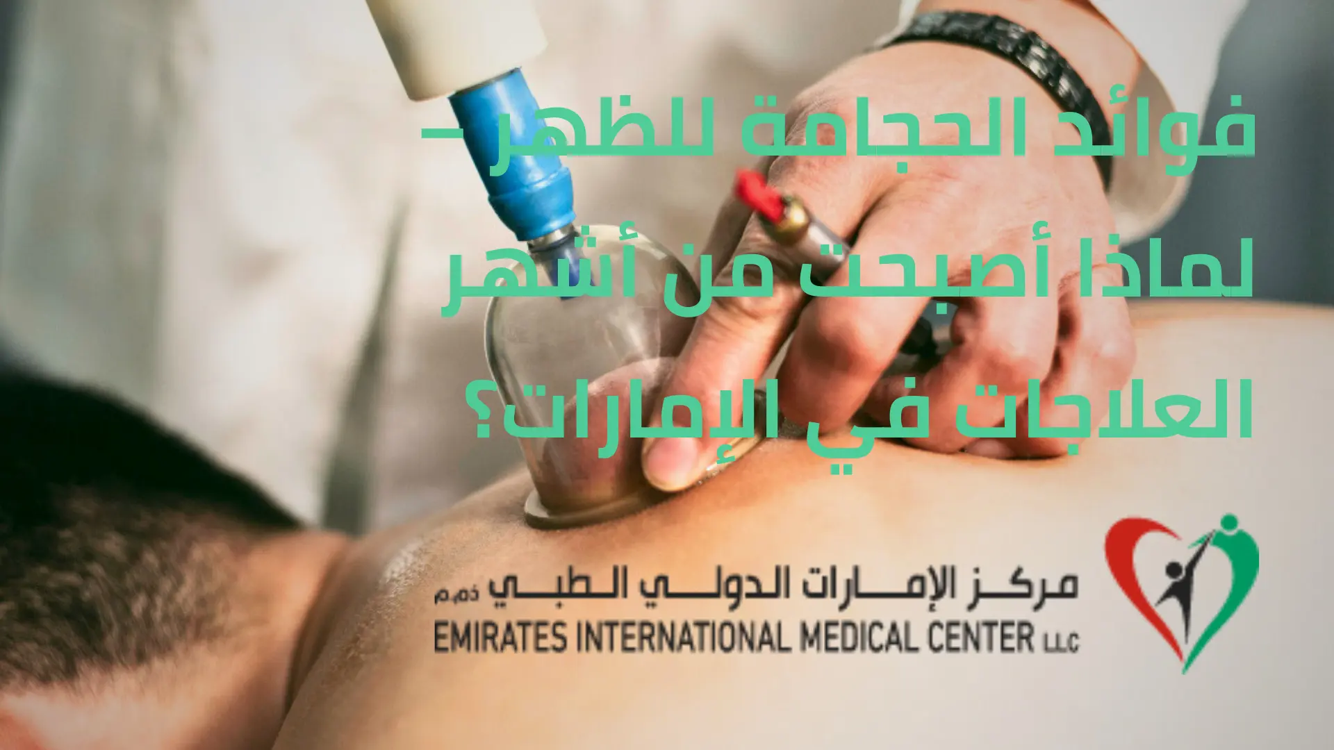 فوائد الحجامة للظهر - مركز الإمارات الدولي الطبي