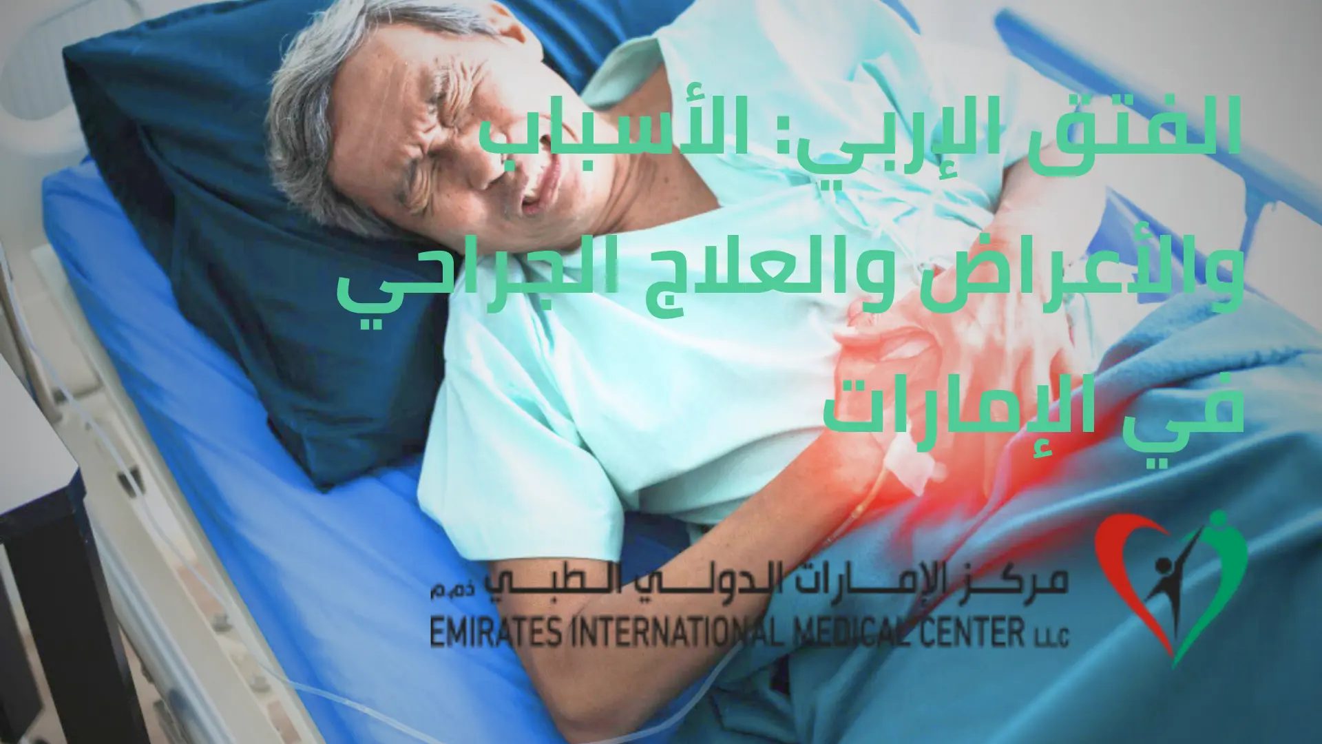 الفتق الإربي: الأسباب والأعراض والعلاج الجراحي في مركز الإمارات الدولي الطبي