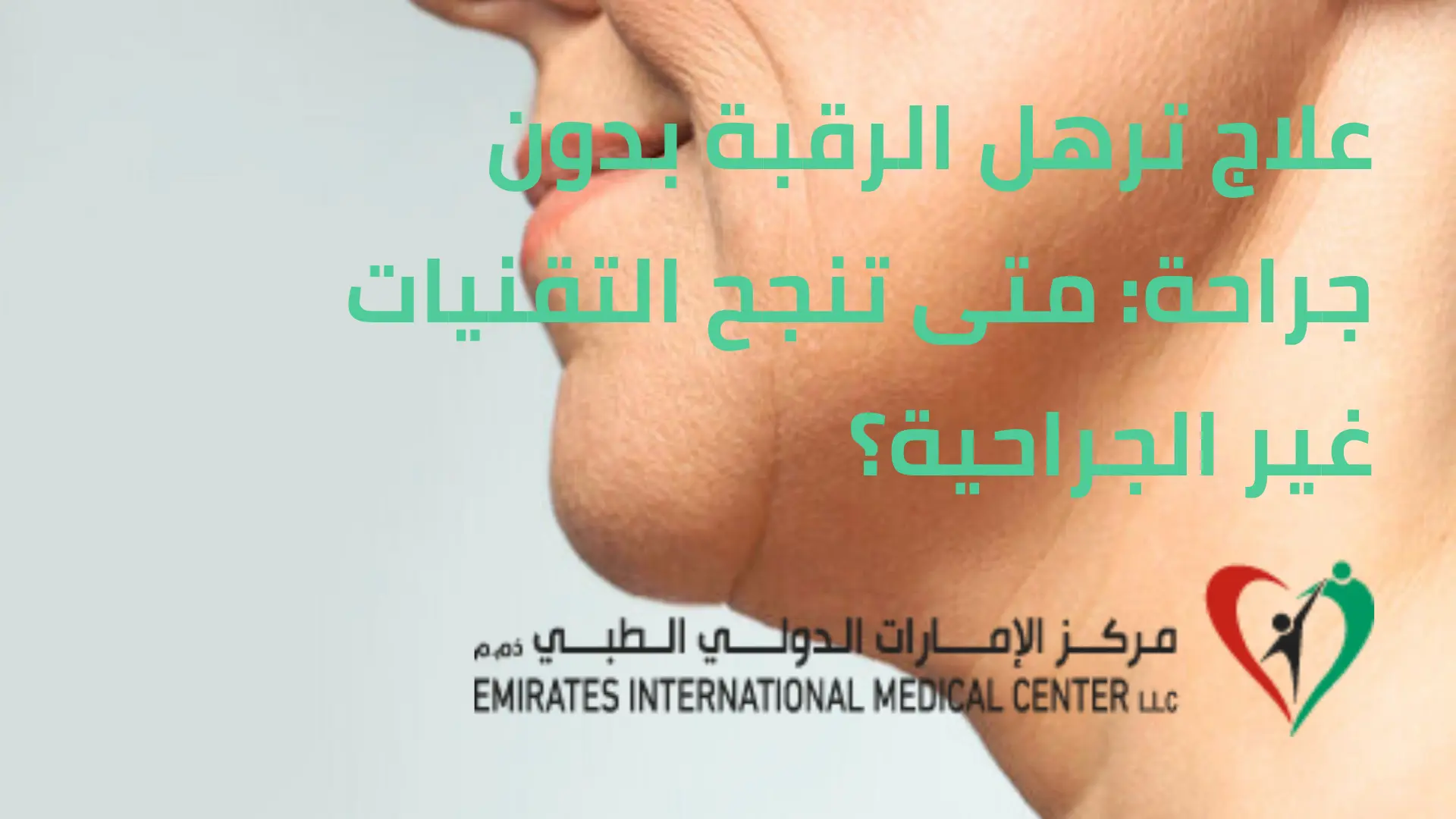 ترهل الرقبة