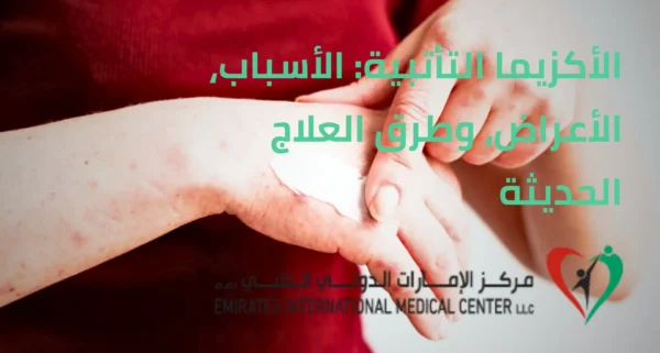 الأكزيما التأتبية | مركز الامارات الدولي الطبي